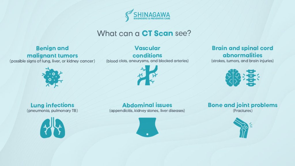 What-Can-A-CT-Scan-See