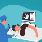 Illustration of a doctor performing a gastroscopy on a patient while viewing the stomach on a monitor in a medical setting.