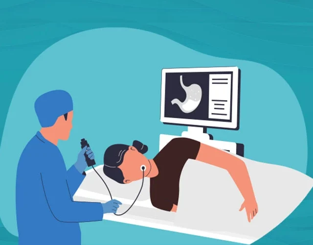 Illustration of a doctor performing a gastroscopy on a patient while viewing the stomach on a monitor in a medical setting.