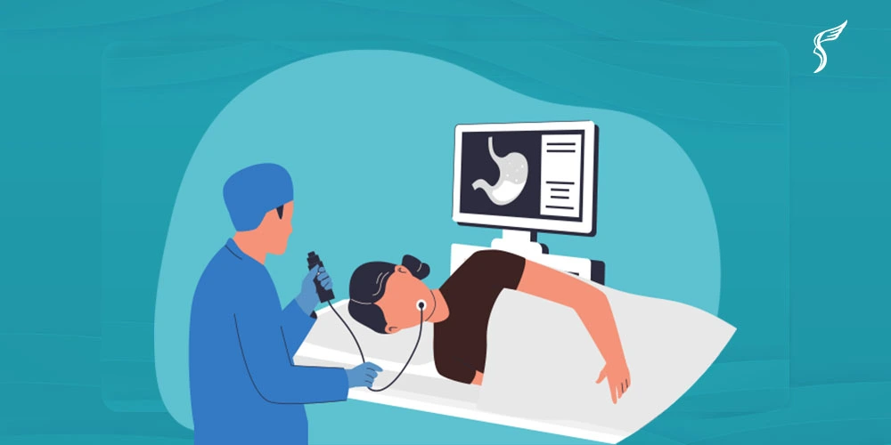 Illustration of a doctor performing a gastroscopy on a patient while viewing the stomach on a monitor in a medical setting.