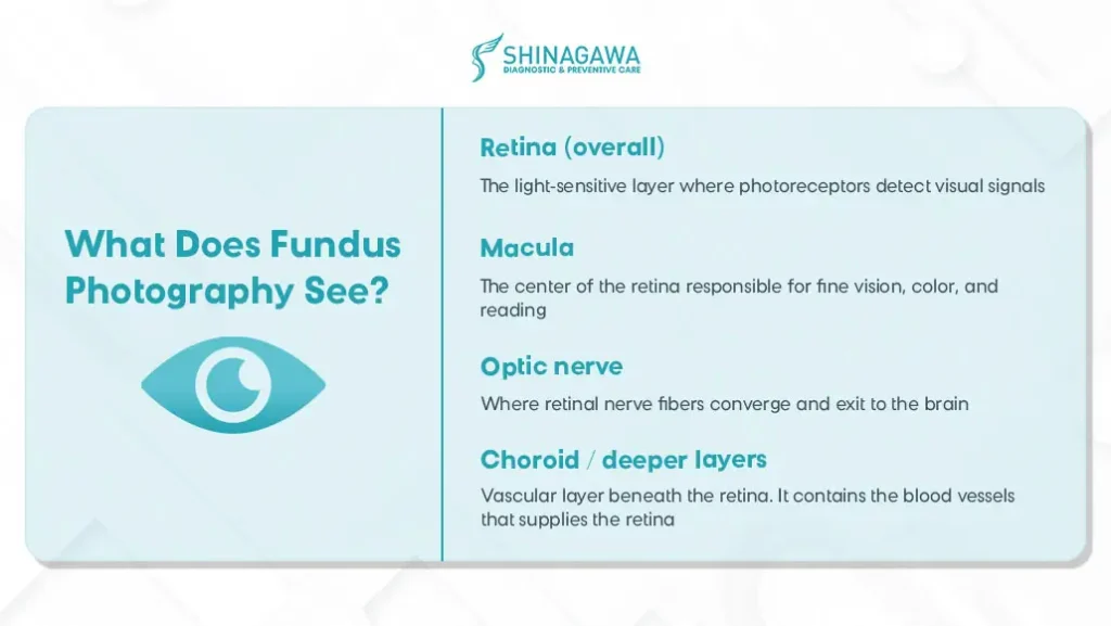 Infographic from Shinagawa explaining what fundus photography detects: retina, macula, optic nerve, and choroid or deeper eye layers.