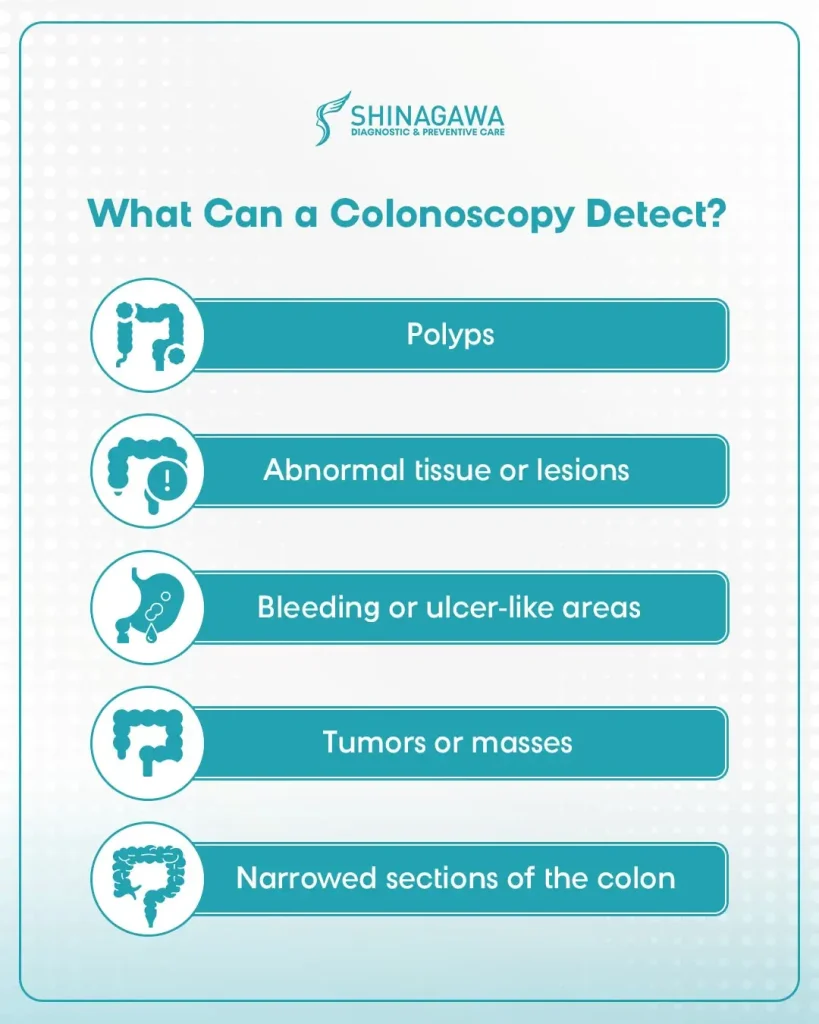 Infographic from Shinagawa Diagnostic & Preventive Care listing what a colonoscopy can detect, including polyps, abnormal tissue, bleeding, tumors, and narrowed sections of the colon.