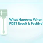 Illustration of two stool sample test kits with the text “What Happens When Your FOBT Result is Positive?” by Shinagawa Diagnostic & Preventive Care, addressing positive fecal occult blood test results.