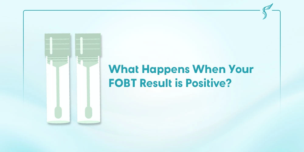 Illustration of two stool sample test kits with the text “What Happens When Your FOBT Result is Positive?” by Shinagawa Diagnostic & Preventive Care, addressing positive fecal occult blood test results.