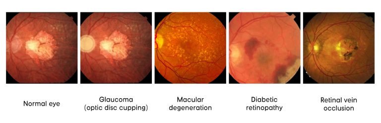 High Risk Eyes Ophthalmology and Eye Care Services | Shinagawa Diagnostic & Preventive ...