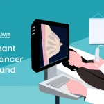 Malignant Breast Cancer Ultrasound: Features, Comparisons, and What Patients Should Know