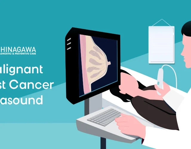 Malignant Breast Cancer Ultrasound: Features, Comparisons, and What Patients Should Know