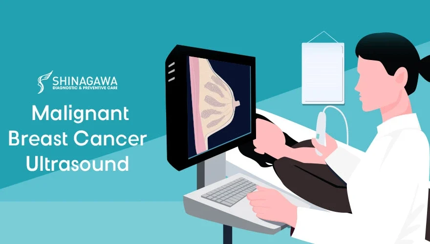 Malignant Breast Cancer Ultrasound: Features, Comparisons, and What Patients Should Know