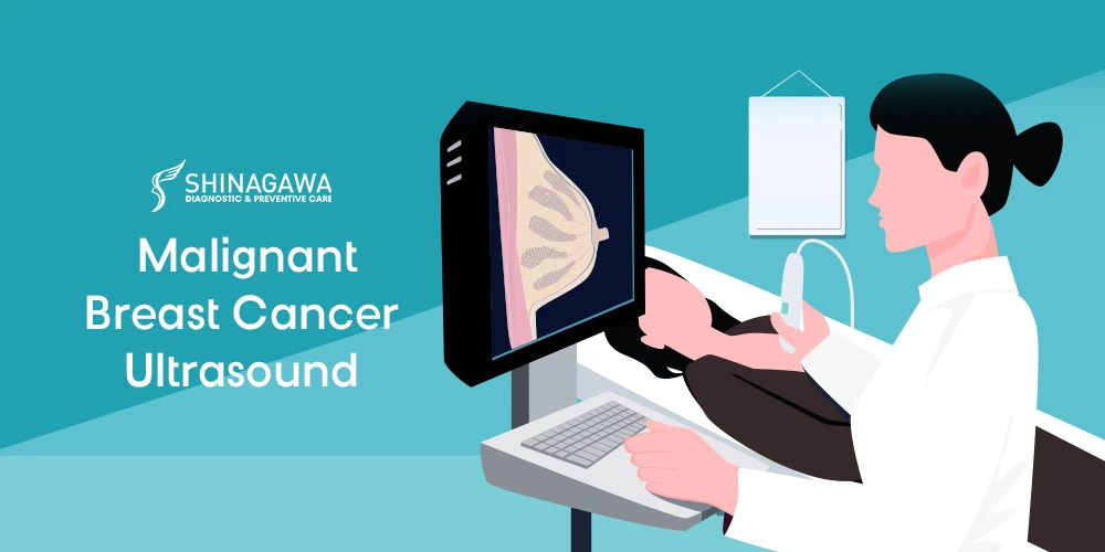 Malignant Breast Cancer Ultrasound: Features, Comparisons, and What Patients Should Know