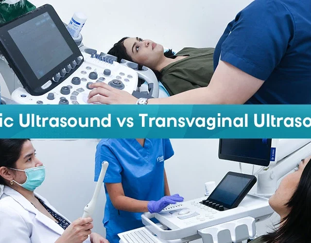 Pelvic Ultrasound vs Transvaginal Ultrasound: Understanding Their Role in Women’s Health