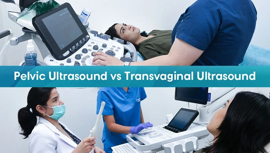 Pelvic Ultrasound vs Transvaginal Ultrasound: Understanding Their Role in Women’s Health