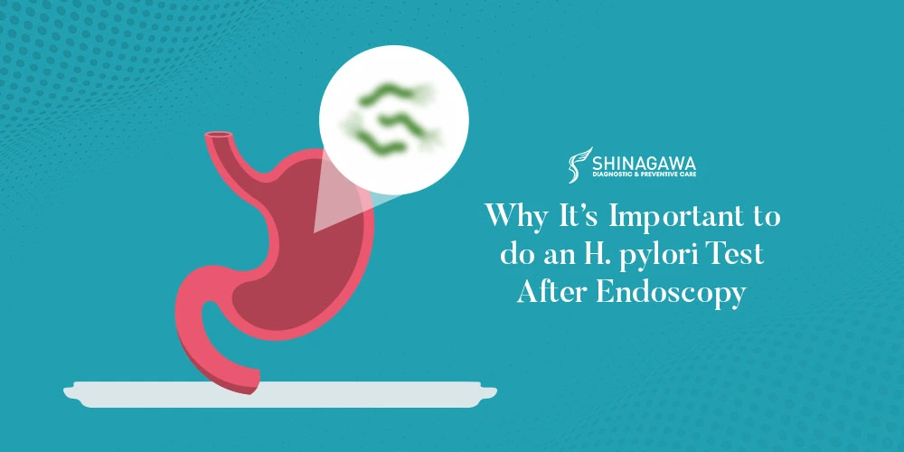Why It’s Important to Do an H. pylori Test After Endoscopy