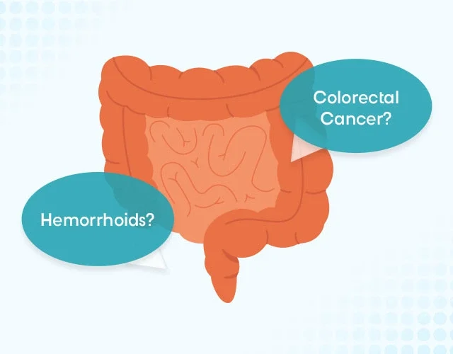 Hemorrhoids vs colorectal cancer difference