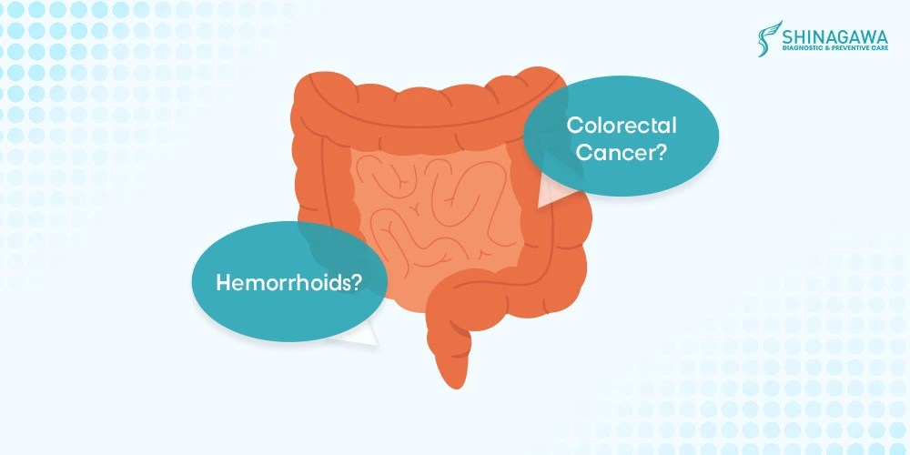 Hemorrhoids vs colorectal cancer difference