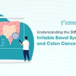 Understanding the Difference Between Irritable Bowel Syndrome and Colon Cancer