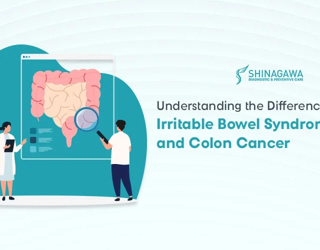 Understanding the Difference Between Irritable Bowel Syndrome and Colon Cancer