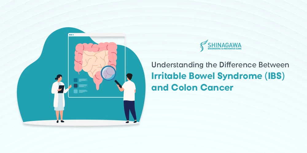 Understanding the Difference Between Irritable Bowel Syndrome and Colon Cancer