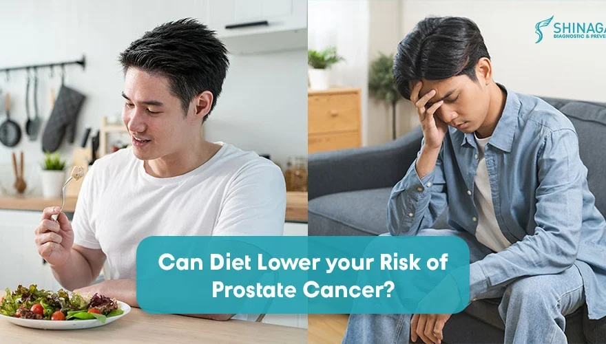 Can Your Diet Help Lower Your Risk of Prostate Cancer?