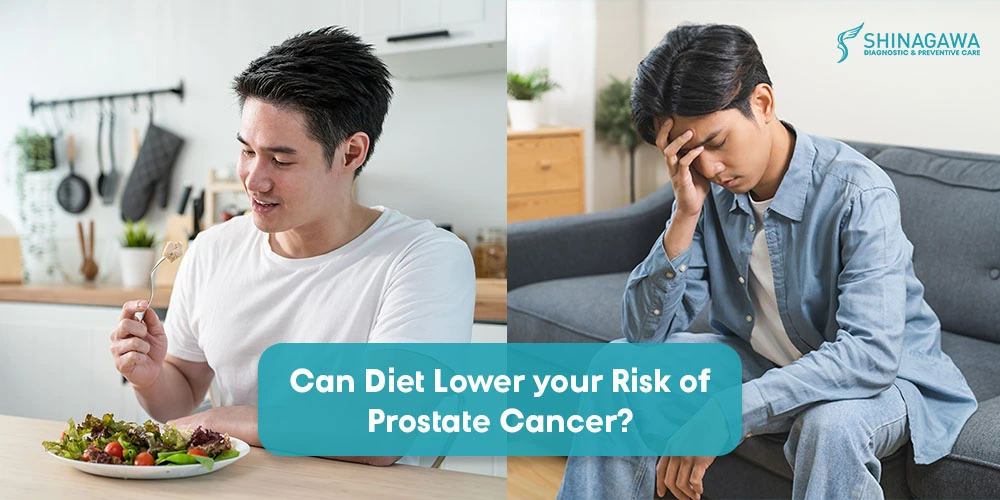 Can Your Diet Help Lower Your Risk of Prostate Cancer?