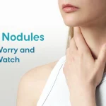 Thyroid Nodules: When to Worry and When to Watch
