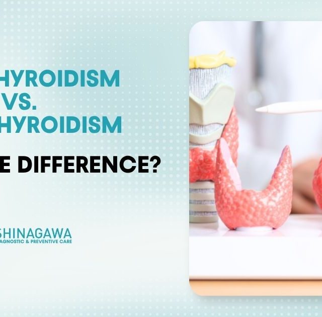 Hyperthyroidism vs. Hypothyroidism: What’s the Difference?