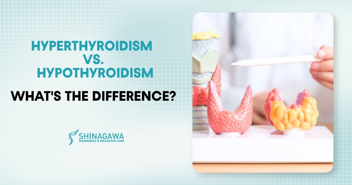 Hyperthyroidism vs. Hypothyroidism: What’s the Difference?