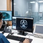 What Causes a Brain Aneurysm? Understanding Risks and Symptoms