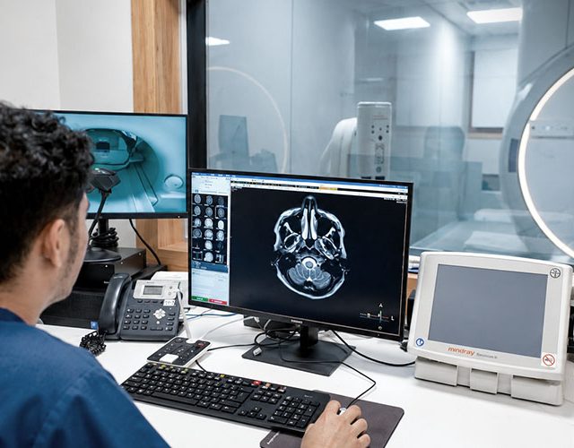 What Causes a Brain Aneurysm? Understanding Risks and Symptoms