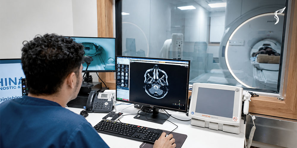 What Causes a Brain Aneurysm? Understanding Risks and Symptoms